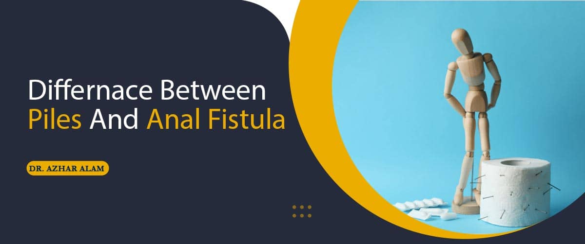 Difference between Piles and Anal Fistula