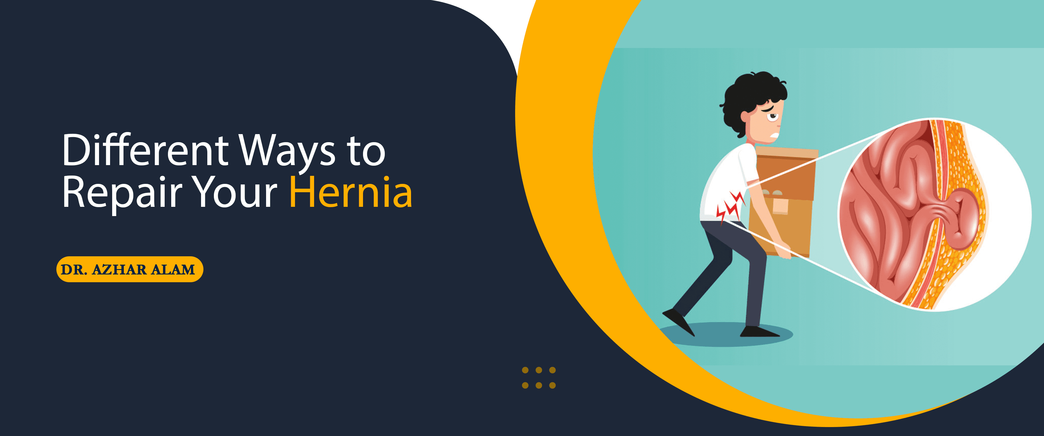 Different Ways to Repair Your Hernia