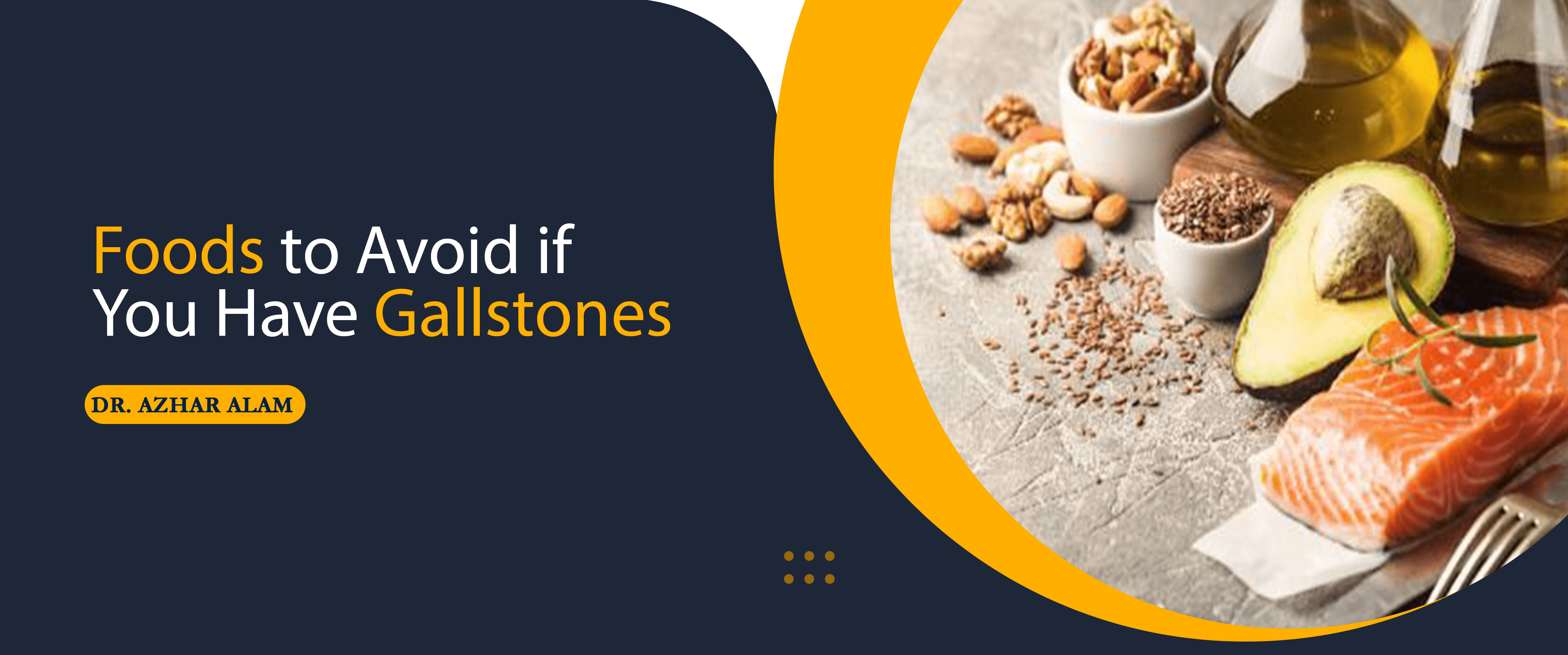 Foods to Avoid if You Have Gallstones