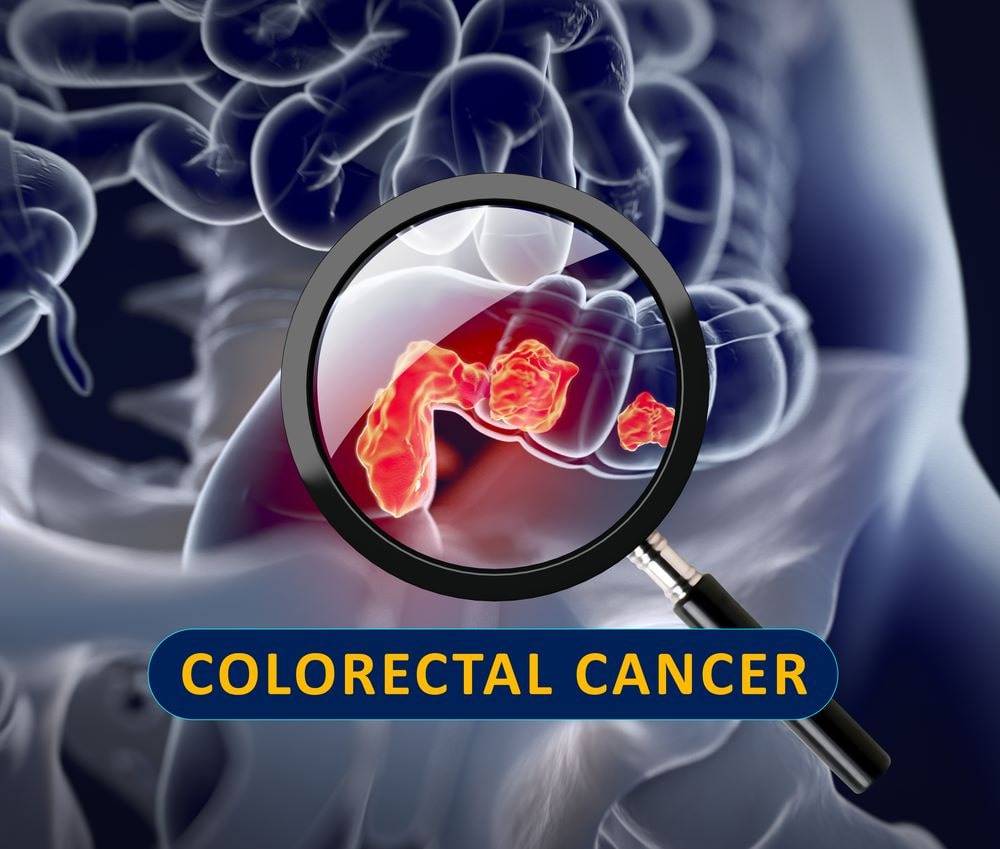 Colorectal