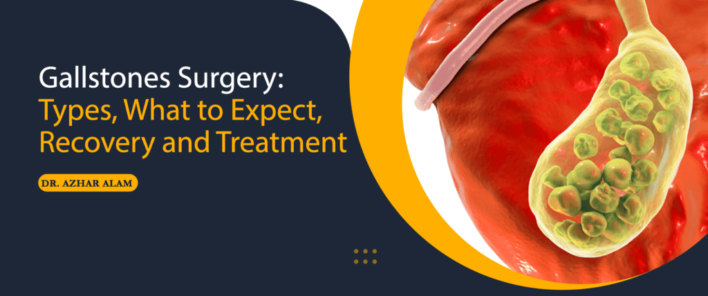 Gallstones Surgery Types, What to Expect and Recovery and Treatment