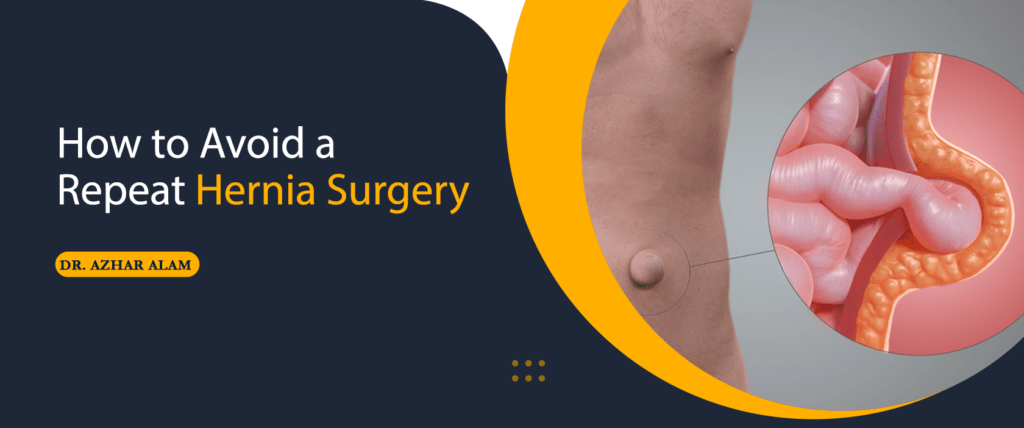 How to Avoid a Repeat Hernia Surgery
