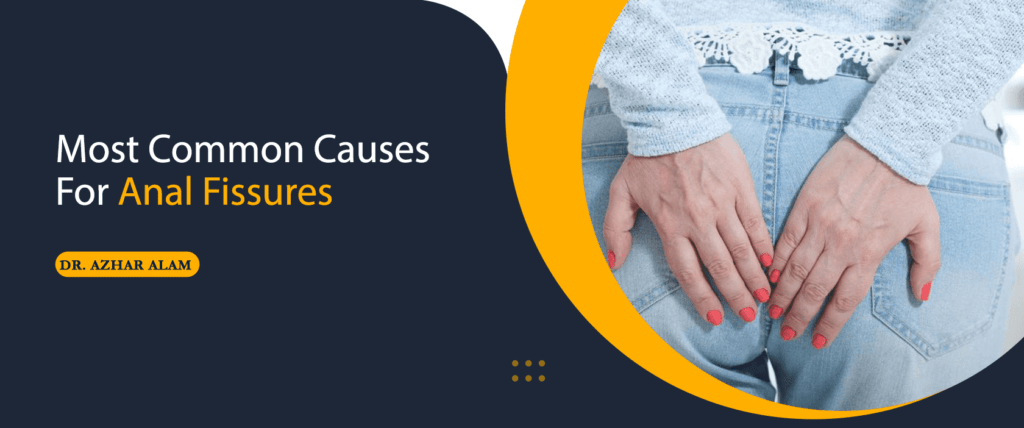 Most Common Causes For Anal Fissures