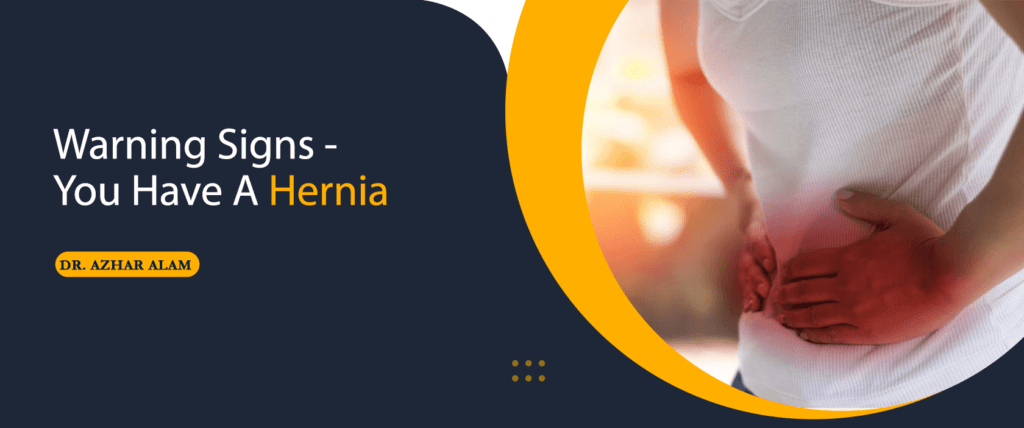 Warning Signs You Have A Hernia