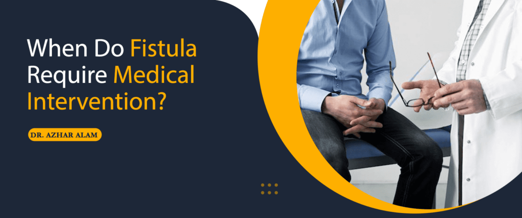 When Do fistula Require Medical Intervention