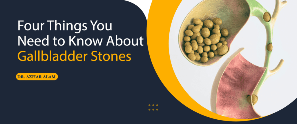 Four Things You Need to Know About Gallbladder stones