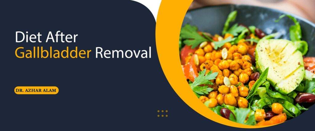 Diet After Gallbladder Removal