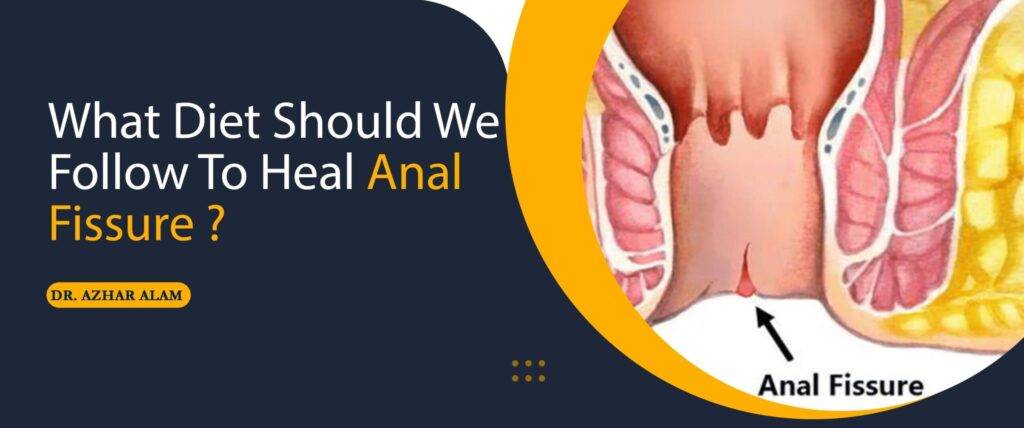 What diet should we follow to heal Anal Fissure