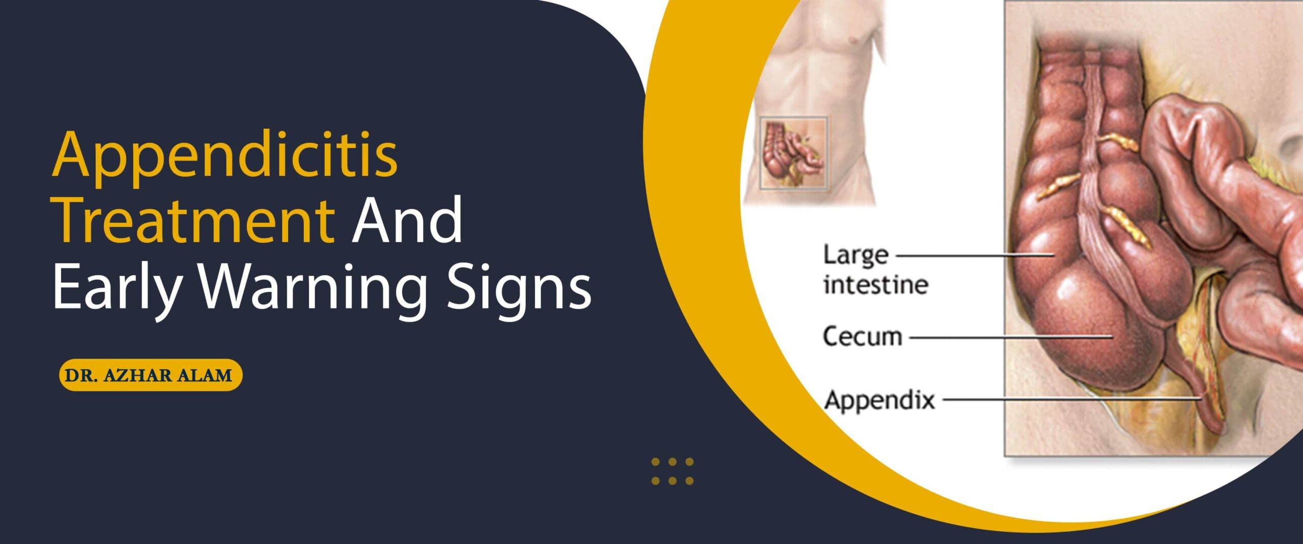 Appendicitis Treatment And Early Warning Signs