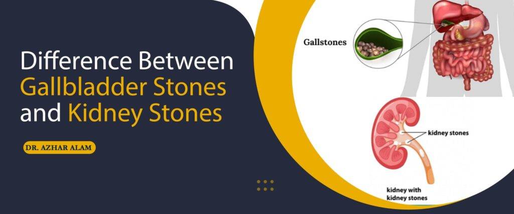 Difference Between Gallbladder Stones and Kidney Stones