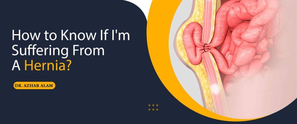 How to Know If I'm Suffering From A Hernia