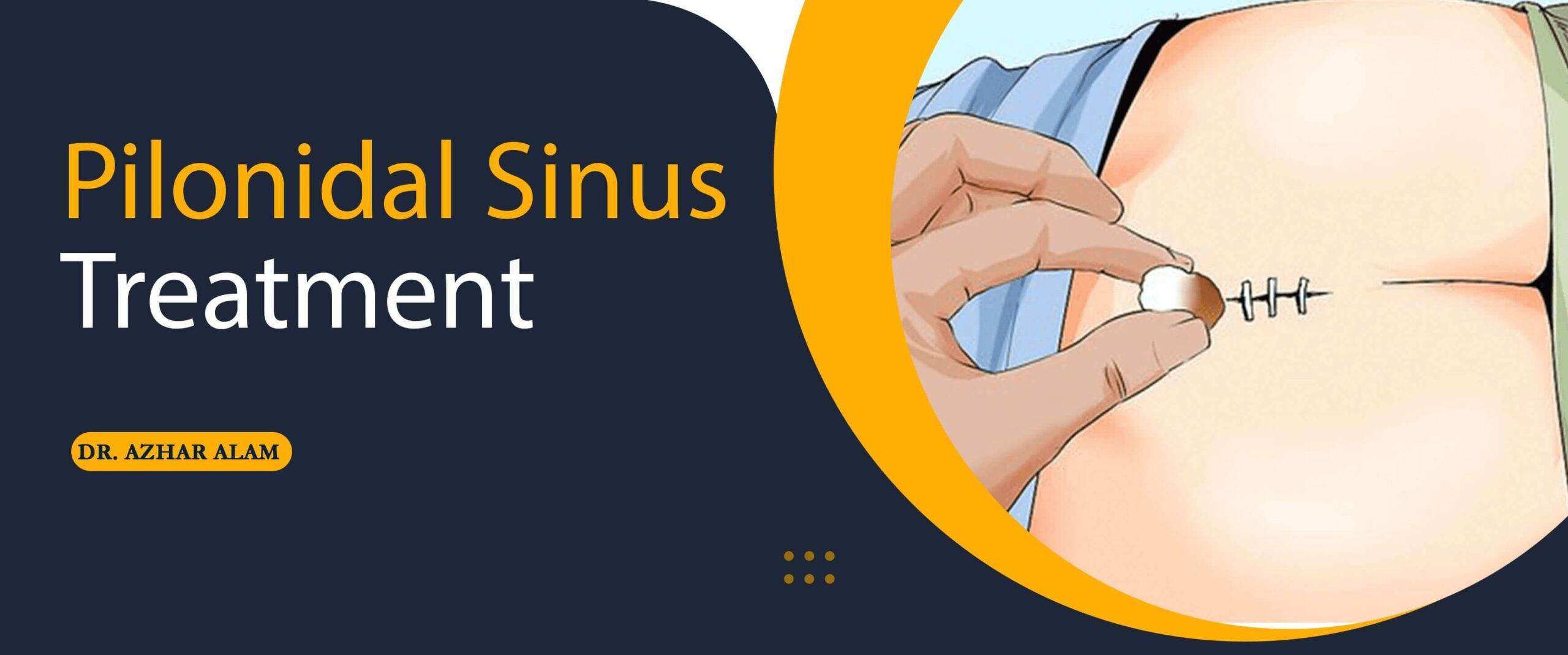 Best pilonidal sinus treatment in delhi
