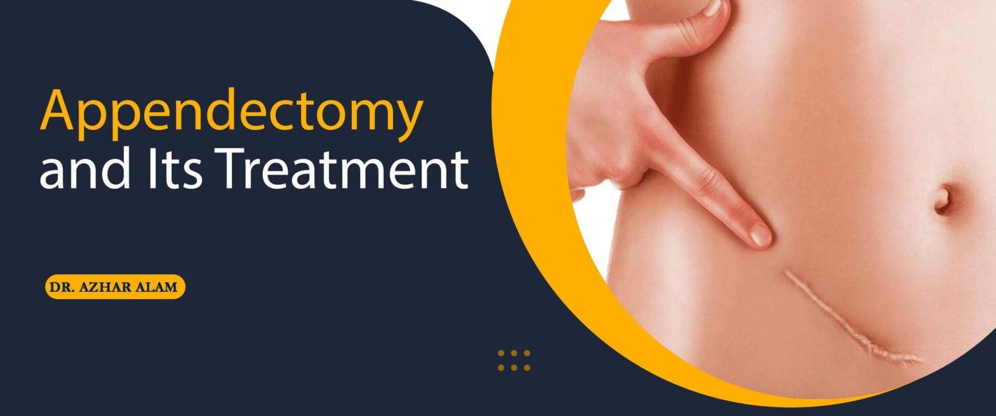 Appendectomy and Its Treatment | Dr. Azhar Alam