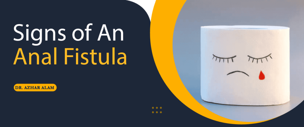 Signs of An Anal Fistula