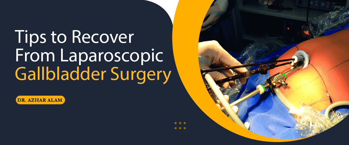 Tips to Recover From Laparoscopic Gallbladder Surgery