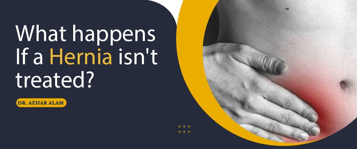 What Happens If a Hernia isn't treated