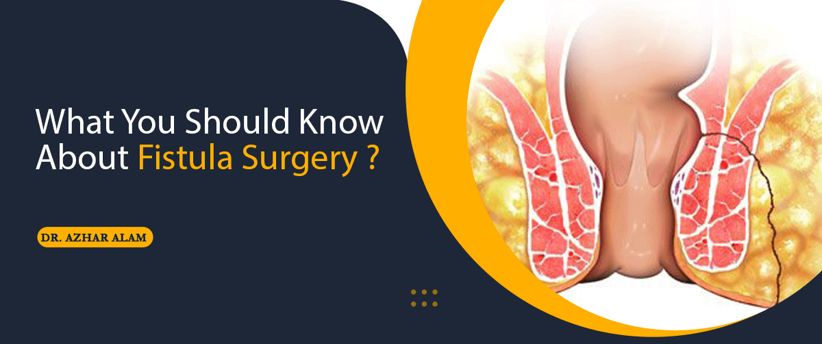 What You Should Know About Fistula Surgery?