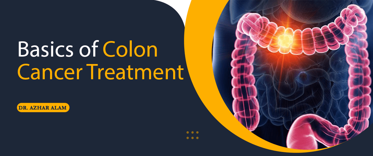 Basics of Colon Cancer Treatment