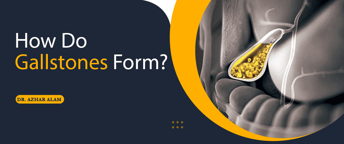 How Do Gallstones Form?