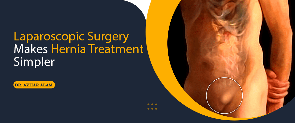 Laparoscopic Surgery for Hernia
