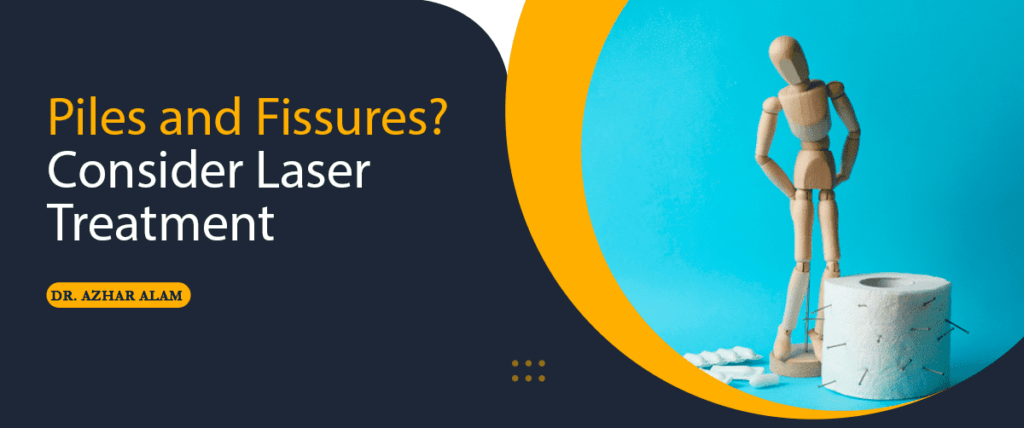 Piles and Fissures? – Consider Laser Treatment