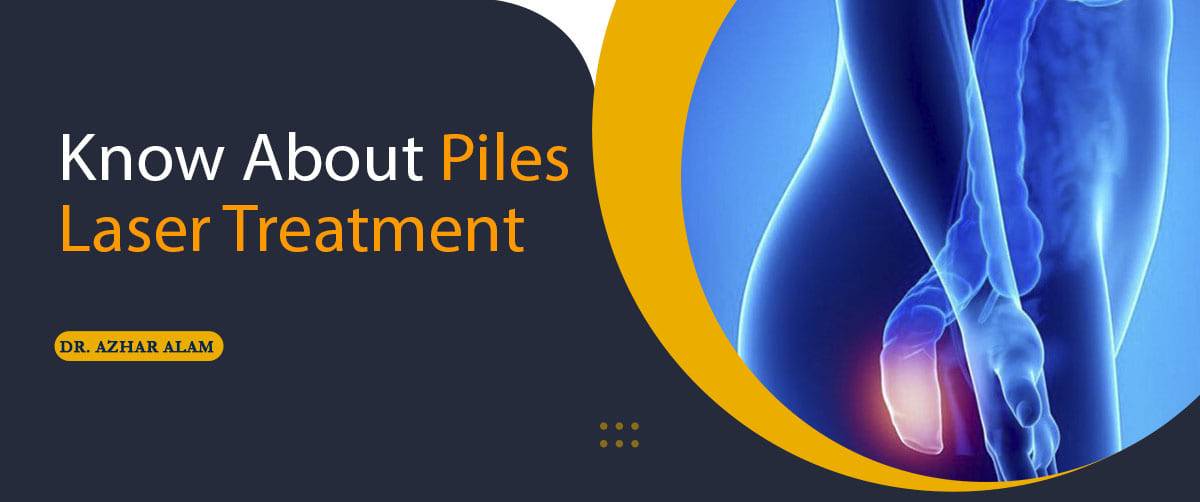 Piles Laser Treatment