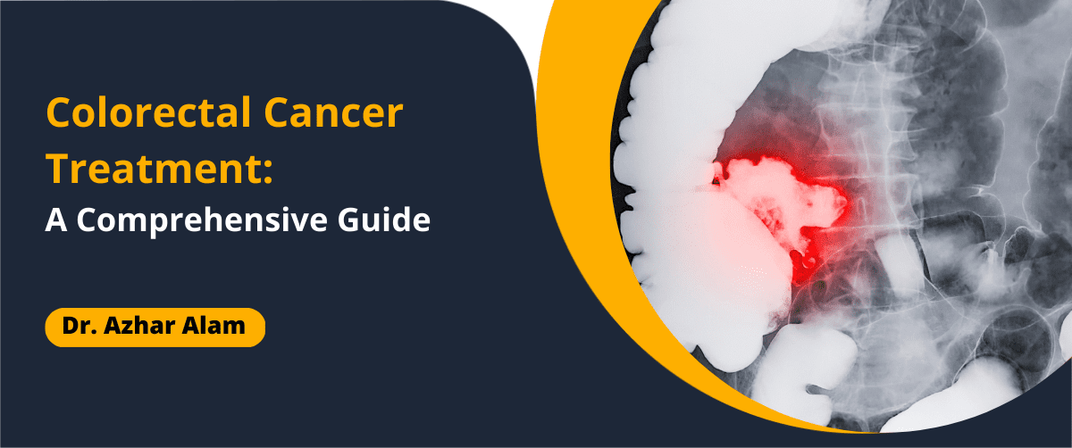 Colorectal Cancer Treatment: A Comprehensive Guide