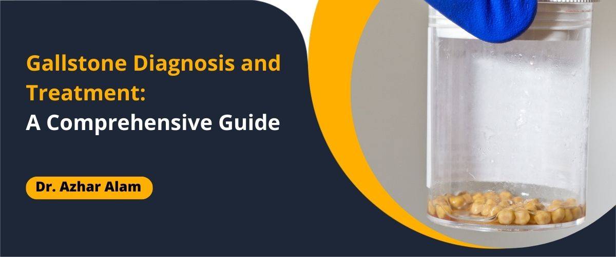 Gallstone Diagnosis and Treatment - A Comprehensive Guide