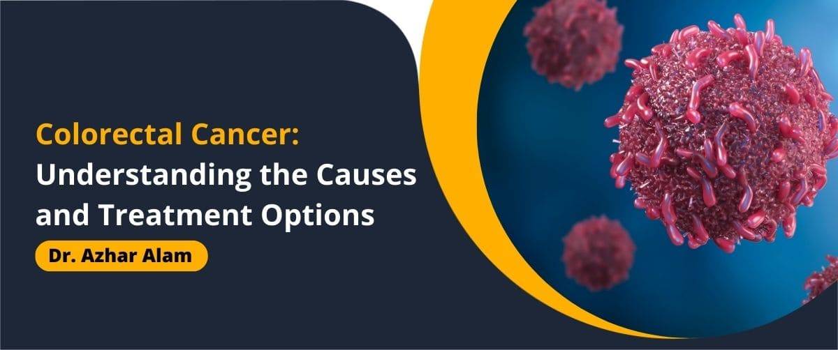 Colorectal Cancer Causes and treatment