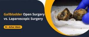 Gallbladder Open Surgery vs. Laparoscopic Surgery
