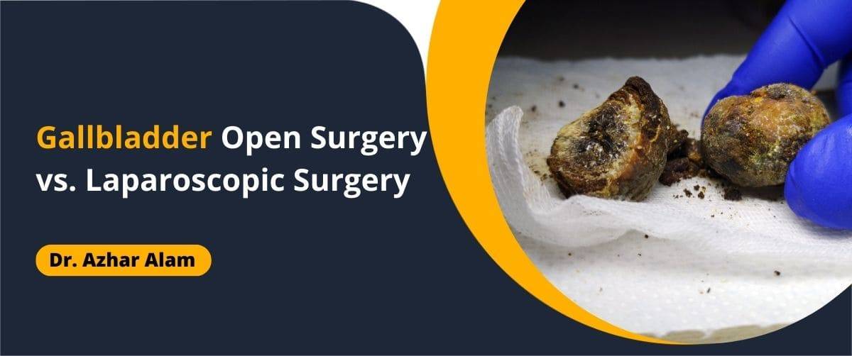 Gallbladder Open Surgery vs. Laparoscopic Surgery
