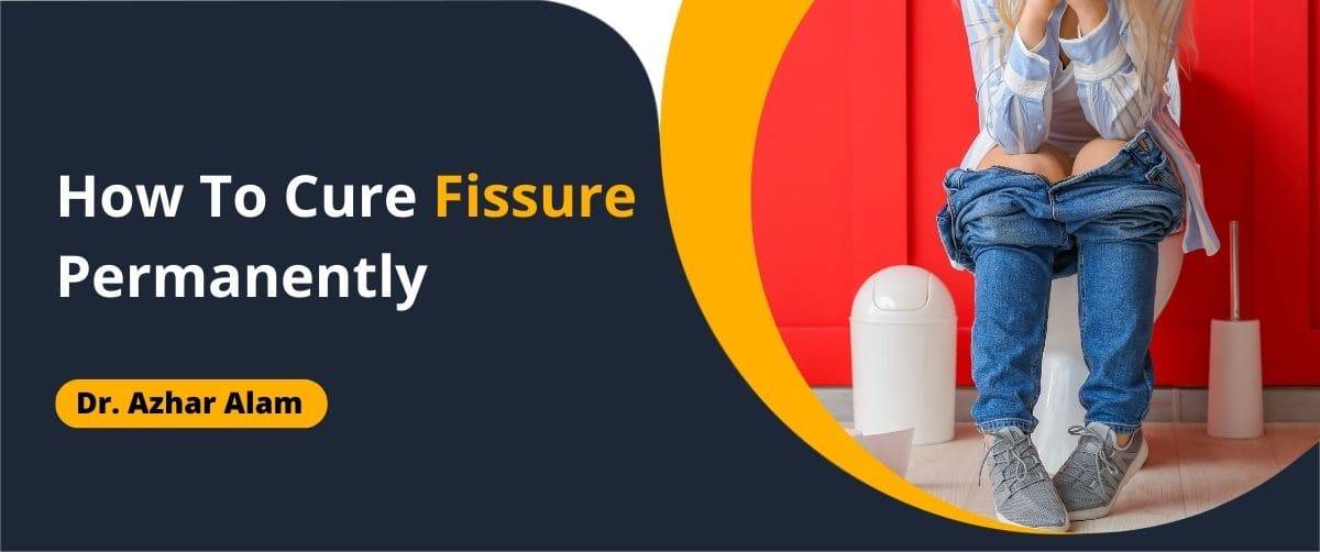 How to Cure Fissure Permanently