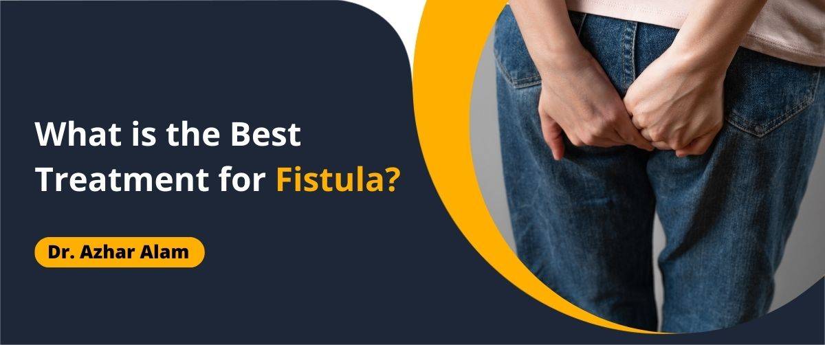 What is the best treatment for fistula?