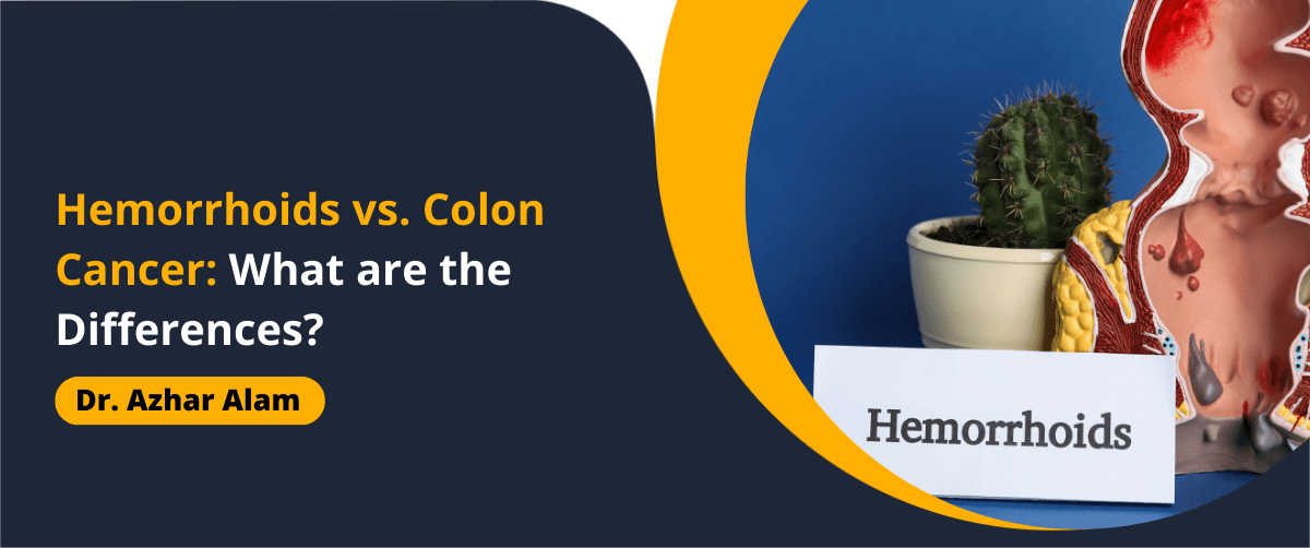 Hemorrhoids vs. Colon Cancer