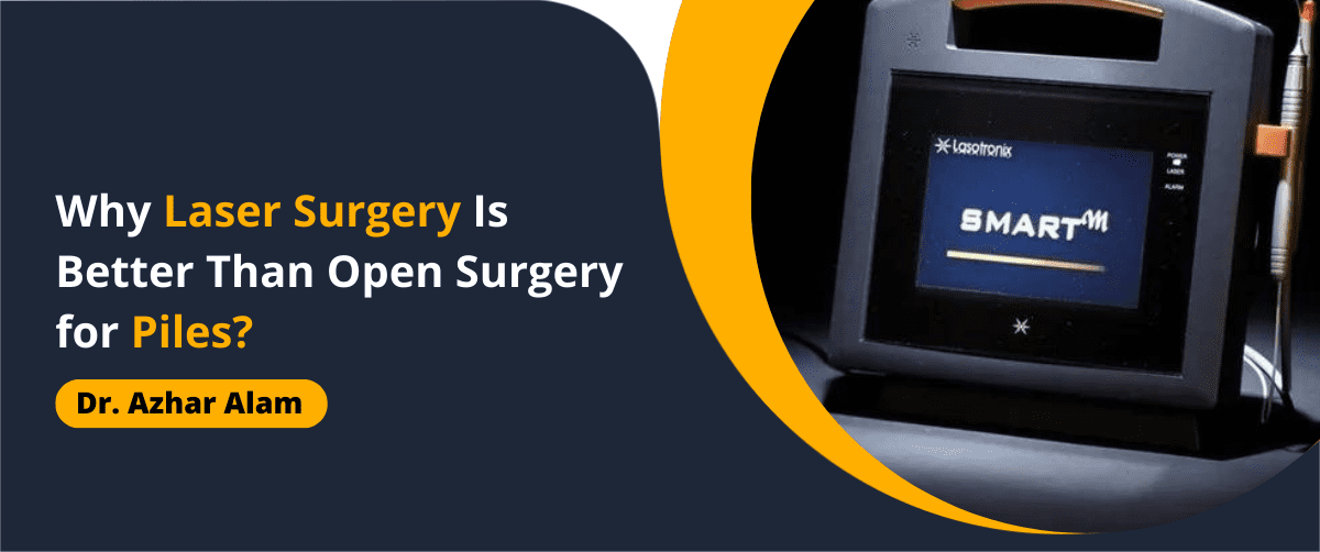 Why Laser Surgery Is Better Than Open Surgery for Piles