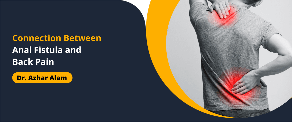 An anal fistula, a distressing condition characterized by an abnormal tunnel-like tract that forms between the anal canal and the skin near the anus, can cause a range of uncomfortable symptoms. While the primary concerns often revolve around issues such as pain, discharge, and discomfort during bowel movements, some individuals with anal fistulas also report experiencing back pain. In this article by Dr Azhar alam, the fistula doctor in Kolkata, the potential relationship between anal fistulas and back pain. It explores this phenomenon's mechanisms, contributing factors, and management strategies. Dr Azhar Alam treats anal fistulas and other related conditions. He will ensure you receive the most effective treatment possible for a fistula and that you are well informed and comfortable throughout the process. He will also provide personalized care and support every step of the way. Understanding Anal Fistulas: Before delving into the correlation between anal fistulas and back pain, it is essential to know the fundamentals of this condition. Anal fistulas typically develop due to an infection in an anal gland, which leads to an abscess. Over time, the abscess may rupture, creating a passageway (fistula) that connects the infected gland to the skin surrounding the anus. This abnormal tract can result in persistent pain, swelling, discharge of pus or blood, and recurrent infections. Mechanisms Linking Anal Fistulas to Back Pain: While the association between anal fistulas and back pain is not universally observed in all cases, several mechanisms may explain why some individuals experience discomfort in the back region. One plausible explanation is the presence of nerve endings in the anal region that transmit pain signals to other parts of the body, including the lower back. Additionally, the inflammatory response triggered by an anal fistula may lead to muscle tension and discomfort in the surrounding area, potentially radiating to the back. Furthermore, individuals with anal fistulas may adopt altered postures or movements to alleviate pain or discomfort during activities such as sitting, walking, or bowel movements. These changes in posture and movement patterns can strain the muscles of the lower back, contributing to the development of back pain over time. Contributing Factors: Several factors may influence the likelihood of back pain associated with an anal fistula. The severity and duration of fistula-related symptoms play a crucial role, as individuals with chronic or recurrent anal fistulas are more likely to develop secondary issues such as back pain. Additionally, the location and extent of the fistula may impact its potential to cause referred pain in the back region. Moreover, underlying conditions such as inflammatory bowel disease (IBD), Crohn's disease, or infections in the pelvic region can predispose individuals to both anal fistulas and back pain. In such cases, the interplay between these conditions may exacerbate symptoms and complicate treatment approaches. Management Strategies: Addressing back pain in the context of anal fistulas requires a comprehensive approach that targets both the underlying cause and the associated symptoms. Here are some management strategies that may help: Treatment of Anal Fistula: The primary focus should be on treating the anal fistula itself to alleviate symptoms and reduce complications. This may involve drainage of abscesses, surgical procedures to excise the fistula tract, or other interventions to promote healing and prevent recurrence. Pain Management: Pharmacological interventions such as analgesics or anti-inflammatory medications may alleviate back pain associated with anal fistulas. Additionally, topical treatments or sitz baths can provide symptomatic relief and promote relaxation of the muscles in the anal and back regions. Physical Therapy: Physical therapy modalities such as gentle stretching exercises, massage, and postural corrections can benefit individuals experiencing back pain related to anal fistulas. A skilled physical therapist can tailor an exercise program to address muscle imbalances, improve flexibility, and enhance overall spinal health. Lifestyle Modifications: Encouraging lifestyle changes such as maintaining a healthy weight, practicing healthy bowel habits, or taking frequent breaks during bowel movements may reduce the risk of anal fistula patients experiencing back pain. Psychological Support: Anal fistulas can negatively affect a person's mental well-being. To manage the psychological impact of this condition, you may seek the assistance of mental health professionals or join a support group. This may indirectly alleviate back pain by reducing stress and tension. Conclusion: While not everyone with an anal fistula will experience back pain, it is essential to recognize the potential interplay between these conditions and address any associated symptoms promptly and comprehensively. To improve the quality of life for individuals suffering from anal fistulas and back pain, fistula specialist doctor need to understand the mechanisms underlying the relationship between these conditions as well as implement appropriate management strategies. So, consult with Dr Azhar Alam, a Fistula Doctor in Kolkata, for diagnosis and proper management of anal fistula. He is an experienced and skilled surgeon and will provide the best possible care. He will also provide advice and tips on how to minimize back pain - Dr Azhar Alam, fistula doctor in Kolkata
