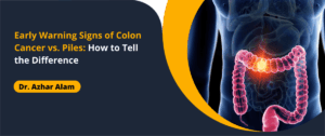Colon Cancer vs. Piles