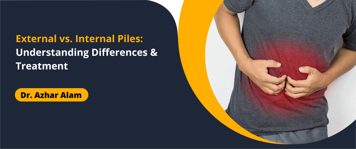 External vs. Internal Piles
