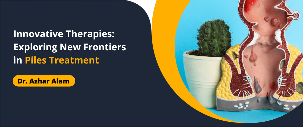 Innovative Therapies in Piles Treatment