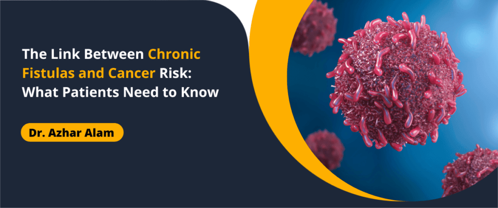 Link Between Chronic Fistulas and Cancer Risk