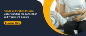 Fistula and Crohn’s Disease