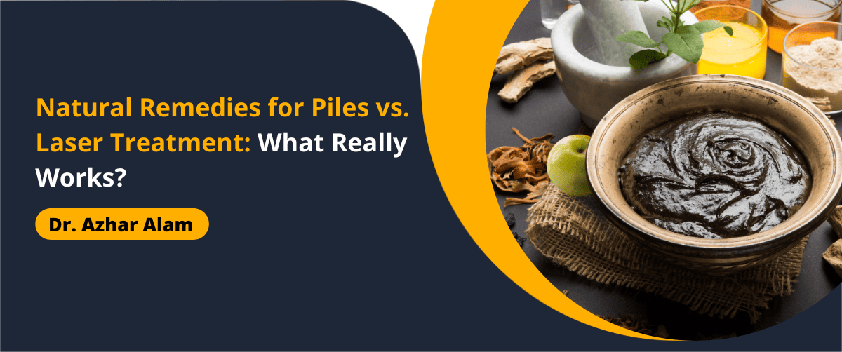 Natural Remedies for Piles vs. Laser Treatment