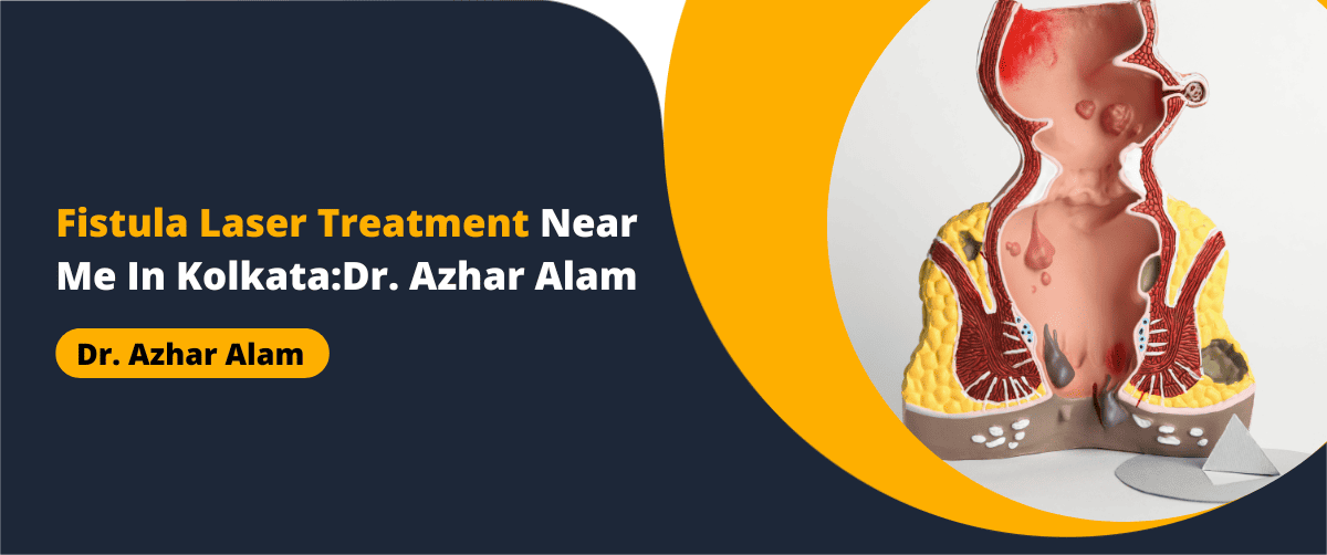Fistula Laser Treatment Near Me In Kolkata: Dr. Azhar Alam