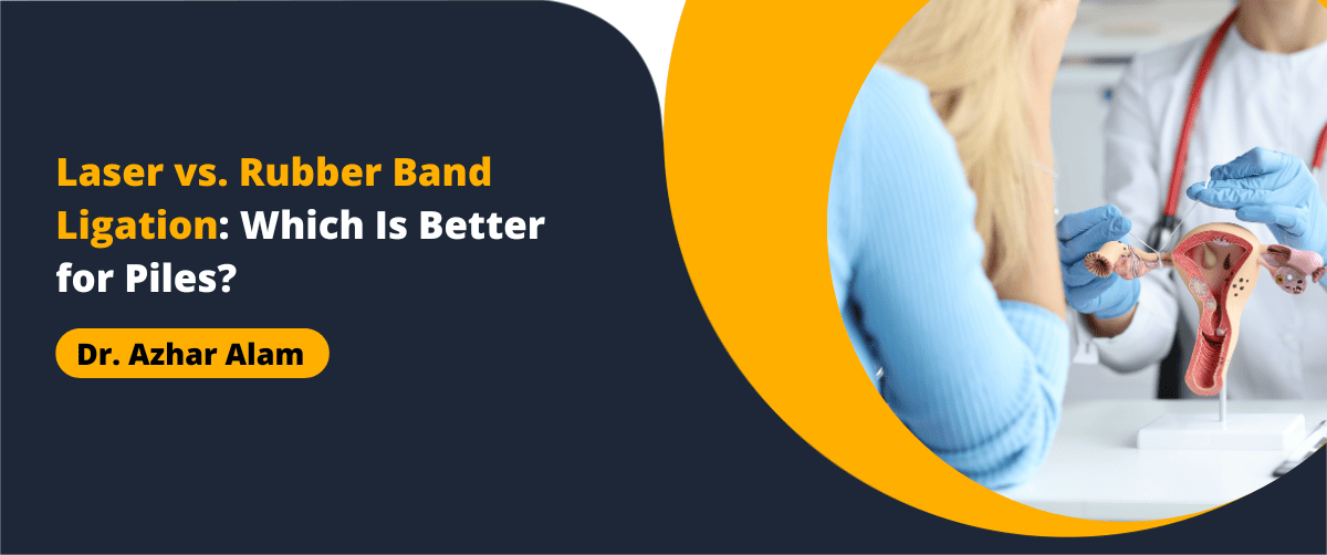 Laser vs. Rubber Band Ligation