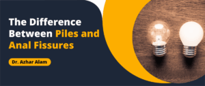 The Difference Between Piles and Anal Fissures