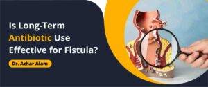 Is Long-Term Antibiotic Use Effective for Fistula?