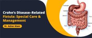 Crohn’s Disease–Related Fistula: Special Care & Management