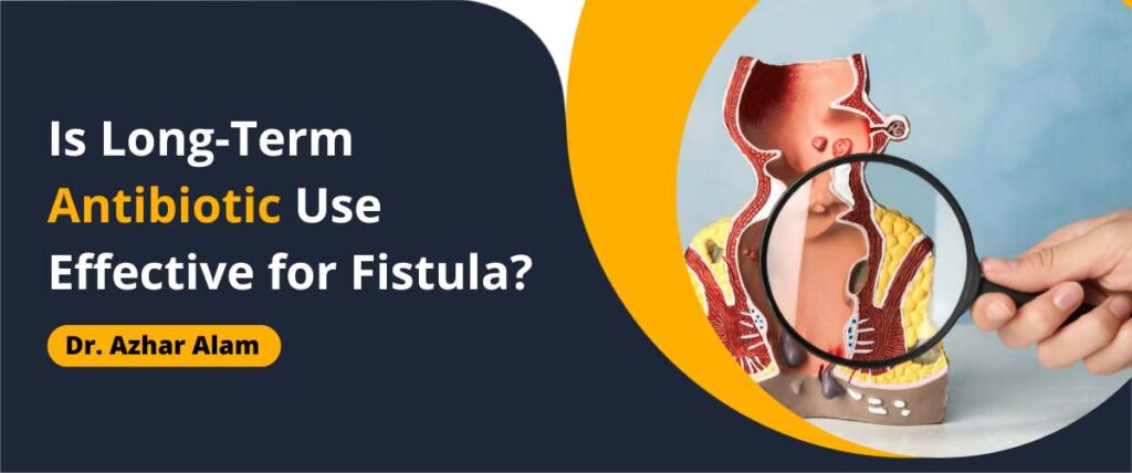 Is Long Term Antibiotic Use Effective for Fistula?