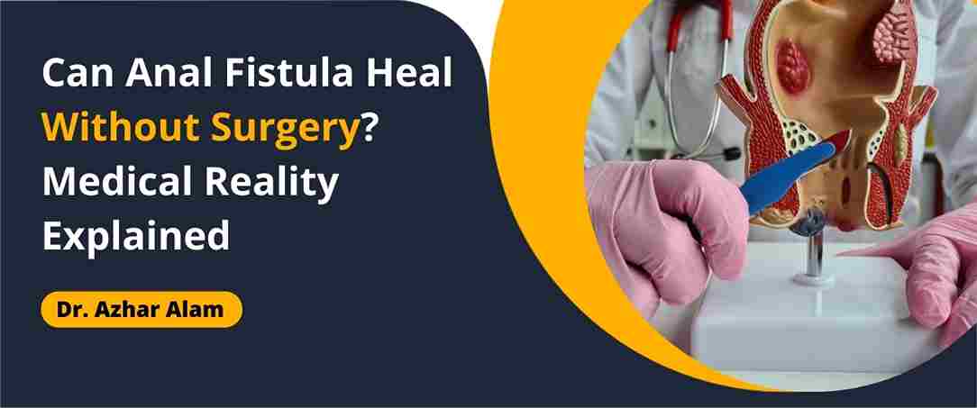 Can anal fistula heal without surgery
