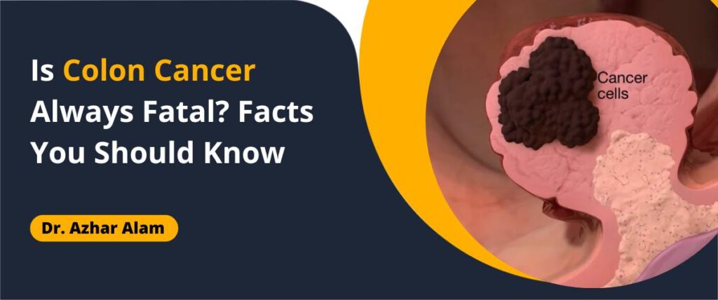 Colon cancer screening and early diagnosis
